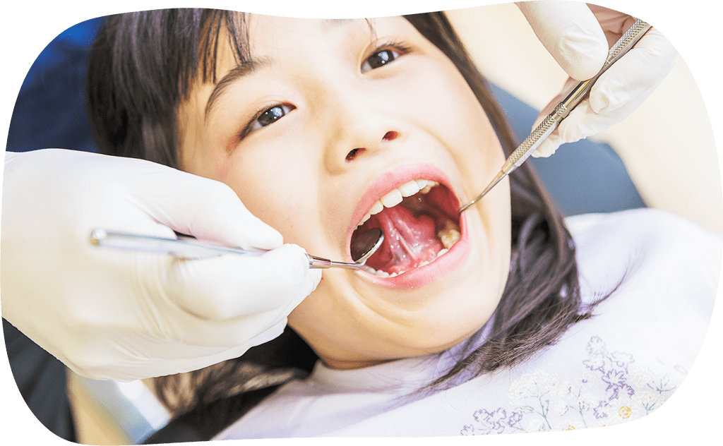 生えたばかりの永久歯は弱い