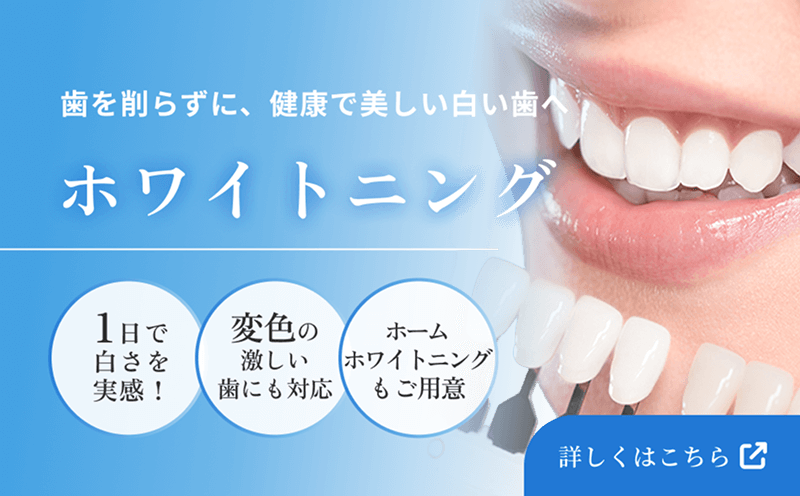 歯を削らずに、健康で美しい白い歯へ　ホワイトニング　1日で白さを実感！　変色の激しい歯にも対応　ホームホワイトニングもご用意